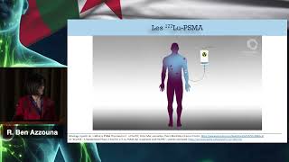 AICONM24 - Les 177Lu-PSMA (R. BEN AZZOUNA)