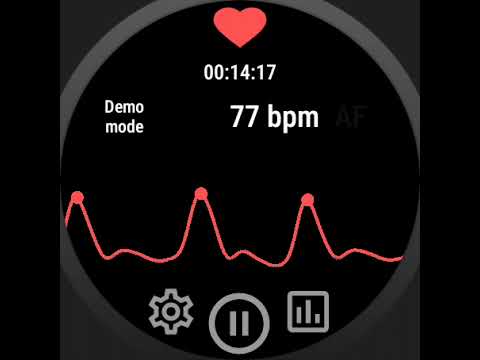 AFib monitor
