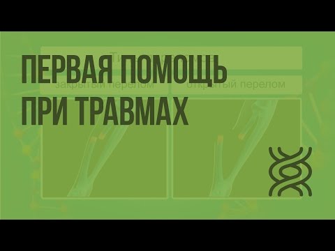 Первая помощь при травмах: растяжениях связок, вывихах суставов, переломах костей. Видеоурок