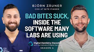 Bite-Finder - The Software Fixing Bad Bites in Digital Dentistry