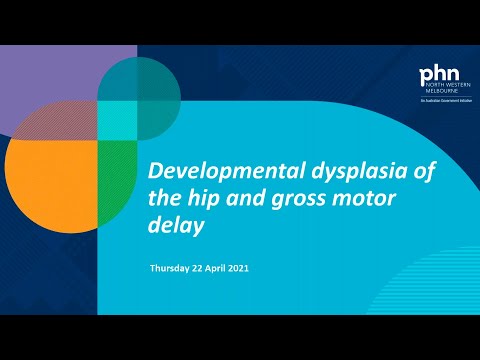 Developmental dysplasia of the hip and gross motor delay (webinar held on 22 April 2021)