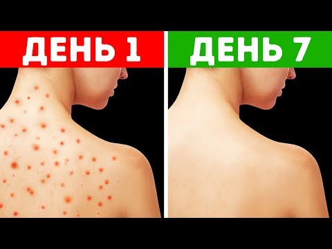 Артроскопия коленного сустава в ниито Боль в спине и дрожь в руках
