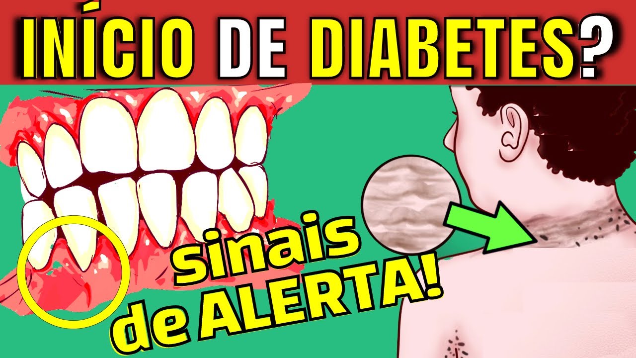 7 EARLY SYMPTOMS OF DIABETES: Warning Signs of Too Much Blood Sugar (Diabetes on the way)?