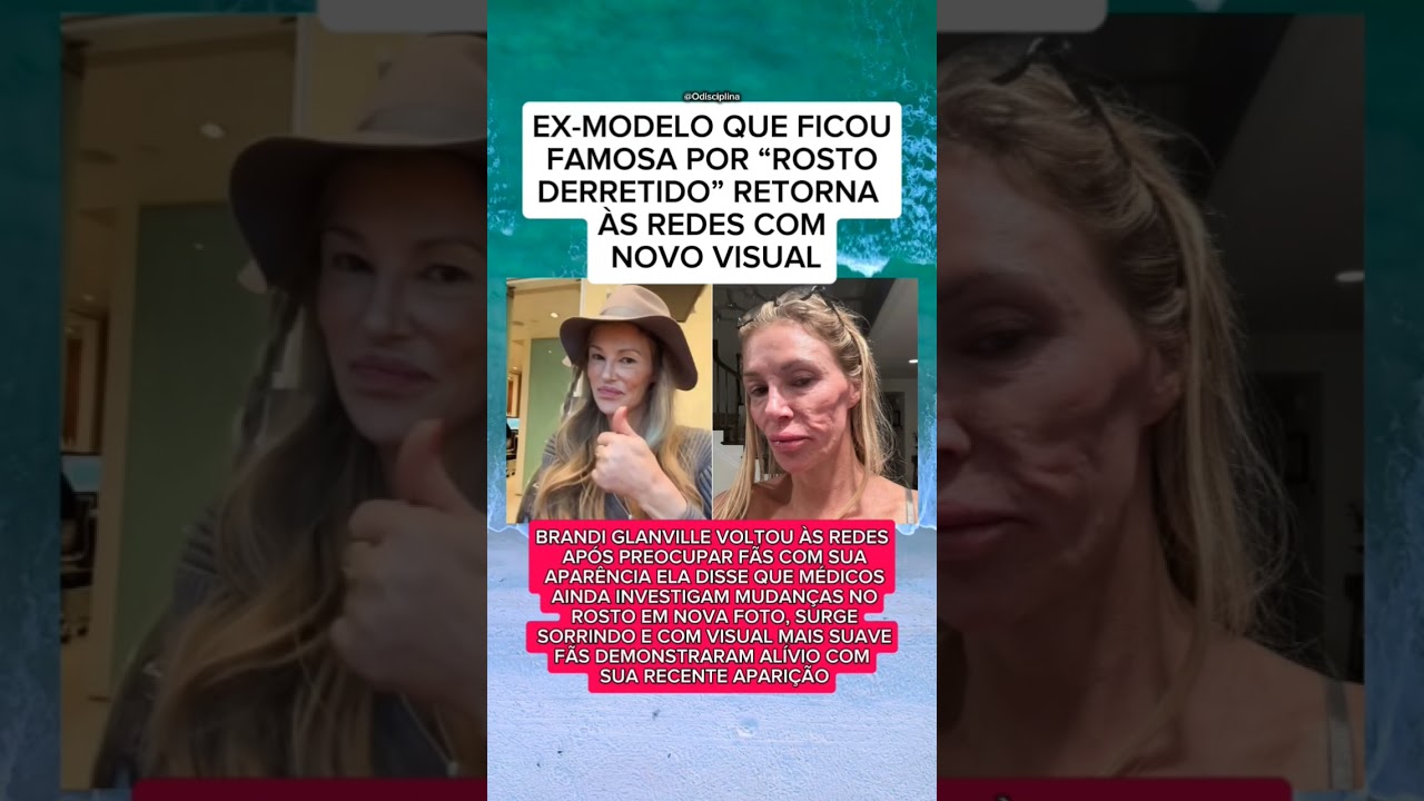 BRANDI GLANVILLE SURGE COM NOVO VISUAL APÓS PREOCUPAR FÃS COM MUDANÇA NO ROSTO..