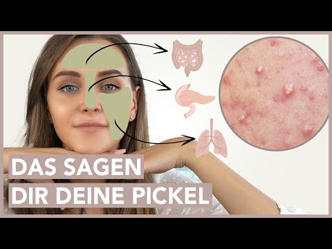 Face Mapping: Woher kommen die Pickel im Gesicht?