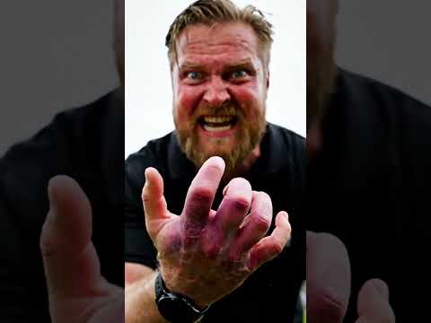 🍉💥 STEIN-MELONE STREICH! 😱 Trainer HAND GEBROCHEN! 🤣 #Streich #Fail #Cappy