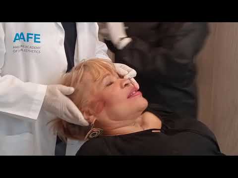 Two Non-Surgical PDO or Smoothing Threads Face and Neck Lifts at Dr. Neal Vallins (Up to 89% Off) - Second Medium