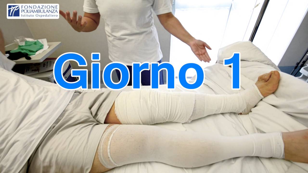 Watch Now Trattamento fisioterapico protesi ginocchio Trattamento fisioterapico protesi ginocchio