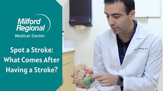 Spot a Stroke: What Comes After Having a Stroke?