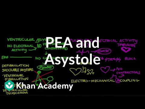 image-What is pulseless electrical activity (PEA)? 