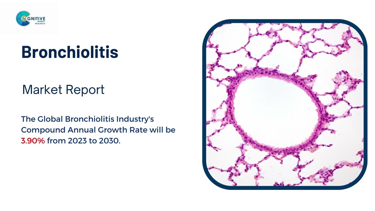 Bronchiolitis  Market Insights