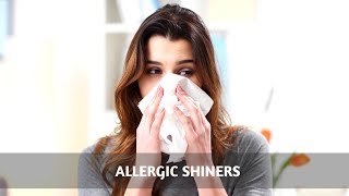 Mouth Breathing And Allergic Shiners