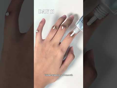 Solve hyperpigmentation spots with Mary&May Tranexamic Acid+Glutathione Eye Cream in 2 WEEKS!