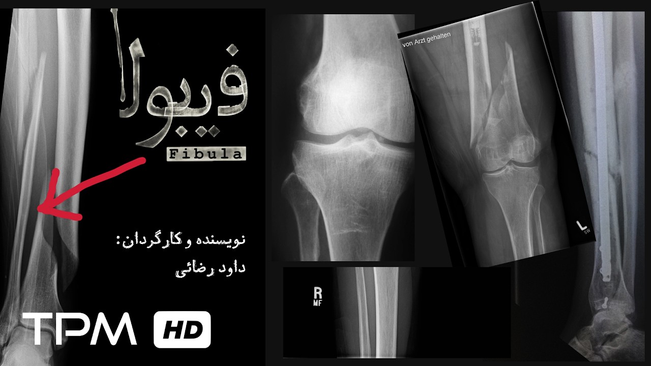 فیلم کوتاه فیبولا با موضوعی جذاب و زیبا | Fibula Shortmovie