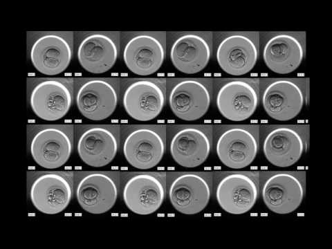 INSTITUT MARQUÈS - Embryos listening to Therr Maitz ("Found You") on demand