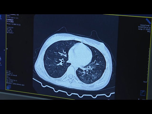 12 ноября – Всемирный день борьбы с пневмонией