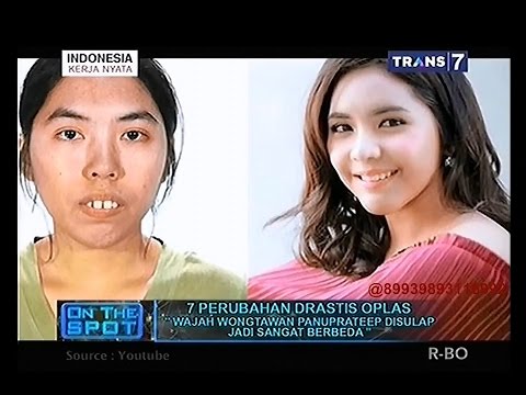 Peningkatan potensi Aloe Patogen murah untuk pria yang dapat Anda beli di toko obat