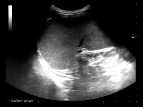 Systeme zur Behandlung von chronischer Prostatitis azithromycin Wie zum Vergnügen Prostata-Massage zu tun