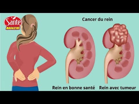Psychosomatique hypertension Crise hypertensive et les sports