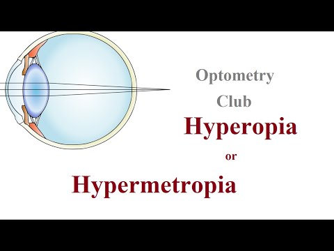 Hyperopia és glaucoma