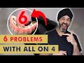 6 Things your Dentist May NOT tell you about All on 4 or a Full Set of Dental Implants