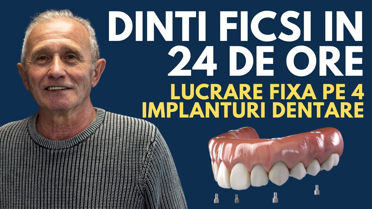 Dantura fixa pe 4 implanturi | Pareri Implant Dentar