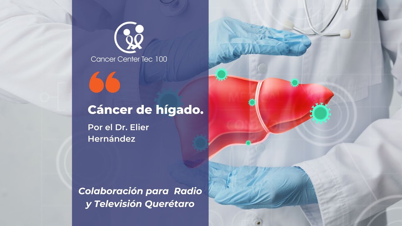 Elier Hernández Martínez-6