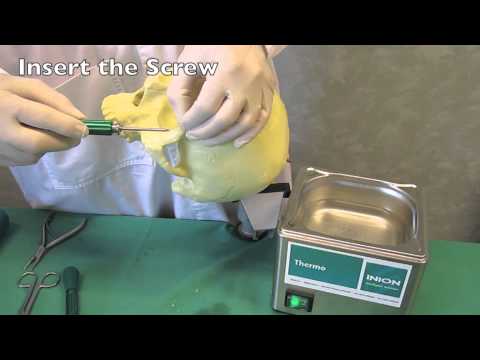 Orbital Rim Fracture Fixation with the Bioabsorbable Inion CPS™ System