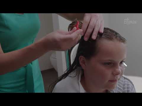 Luizen bestrijden  Hoe herken je luizen bij je kind