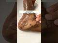 Facepack For Glowing Skin Homemade Hand Feet Tan Removal At Home Shorts Beautytips Skincare