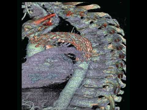 Acid Souljah & 2shanez - Xxuper Villainz (Prod. Seepy & Bleachdiego) 432hz