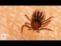 How Ticks Dig In With A Mouth Full Of Hooks Deep Look