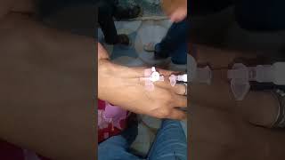 Cannulation video part 1042 #shorts #viral