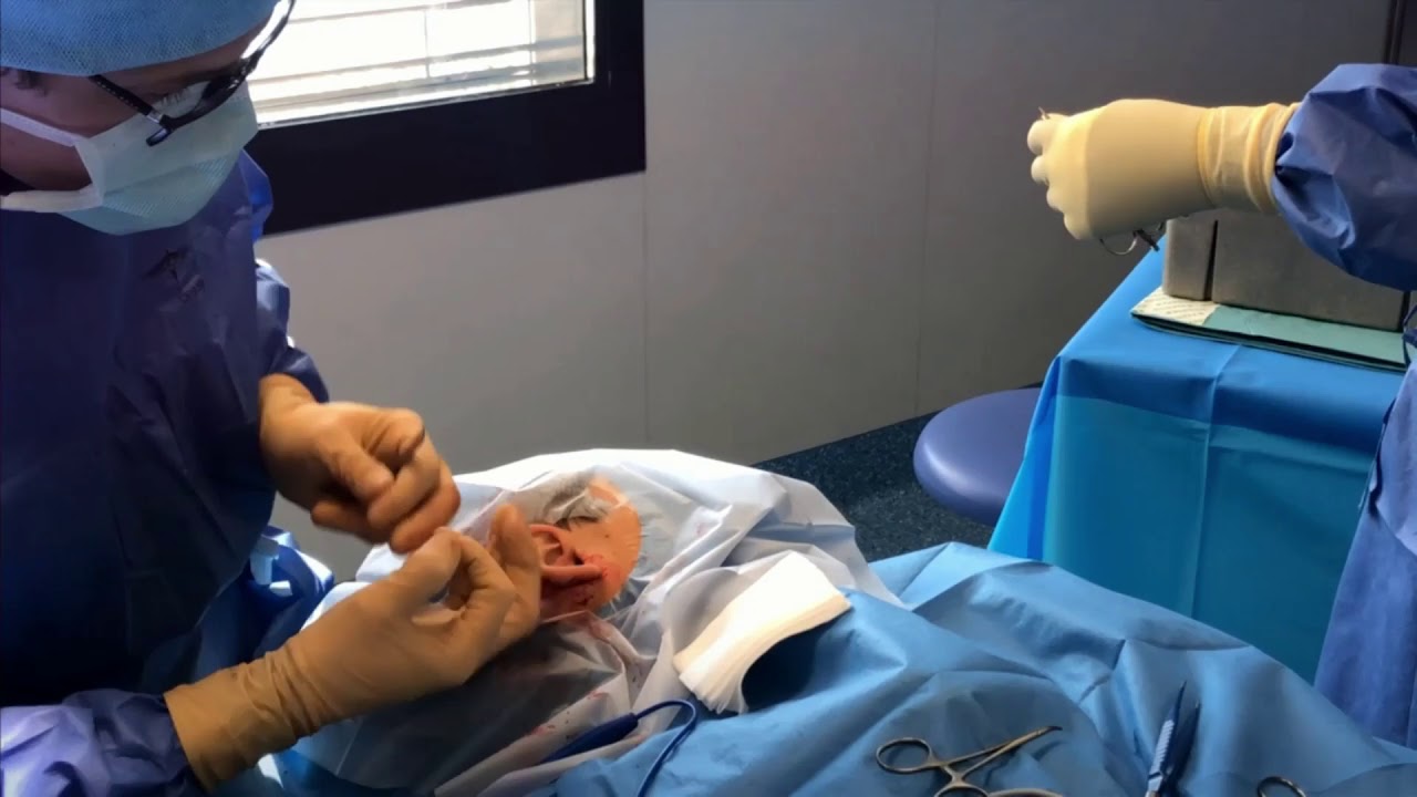 Comment se déroule l'opération d'otoplastie - la chirurgie des oreilles décollées