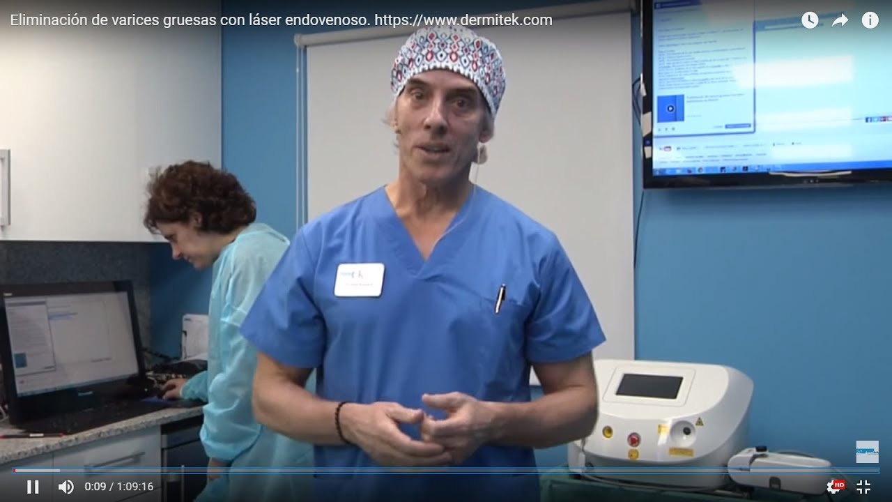 Watch Eliminación de varices gruesas con lÔser endovenoso Now Eliminación de varices gruesas con lÔser endovenoso
