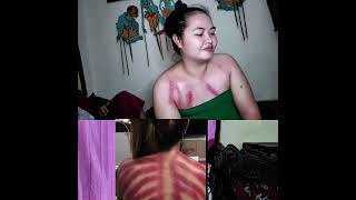 Download lagu Kerokan dada susu wanita masuk angin merah meronah. #fyp #kerokan #masukangin #refleksi #mual mp3 Download lagu Kerokan dada susu wanita masuk angin merah meronah. #fyp #kerokan #masukangin #refleksi #mual mp3