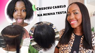 3 MÉTODOS QUE FEZ MEU CABELO CRESCER E PARAR DE CAIR SEM GASTAR NADA | COM FOTOS E PASSO A PASSO 🔥