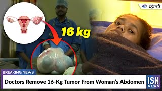 Doctors Remove 16-Kg Tumor From Woman’s Abdomen