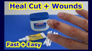 Heal Cut + Wounds Faster & Easier | The Quick Way To Heal Cuts Wound Skin Scrapes Injury