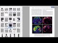 Principles of magnetic resonance imaging solution pdf
