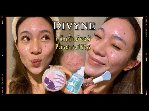 Divyne มาส์กและเซรั่มช่วยลดการอักเสบ ผิวนุ่มชุ่มชื้น เป็นสิว หน้าแพ้ สามารถใช้ได้💙✨ | rrommanee