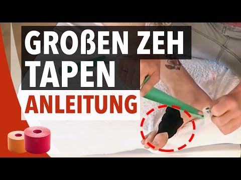 Ob es eine solche Erkrankung Osteochondrose Die Wirkung auf den Körper Osteochondrose der Halswirbelsäule
