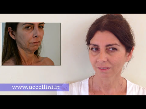 Botox su tutta la persona Buona crema da rughe imitative sotto occhi