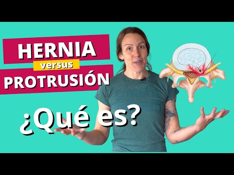 Hernia Discal y Protrusión Discal - ¿Se curan solas? 😱 Todo lo que tienes que saber