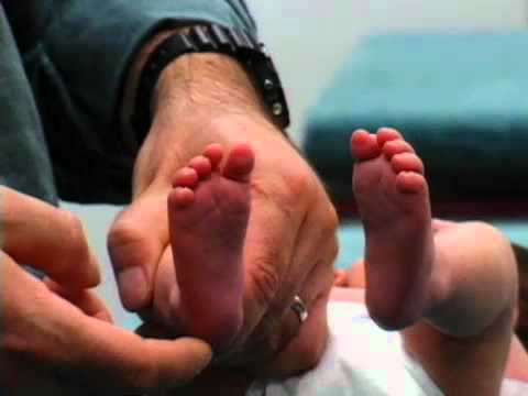 Newborn Reflexes