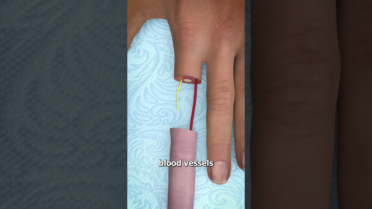 Can You Reattach a Severed Finger? 🤔