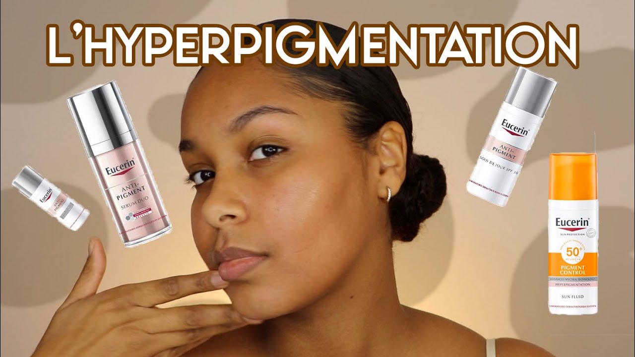 COMMENT RÉDUIRE SON HYPERPIGMENTATION 