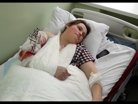 Пострадавшая при взрыве под Воронежем: «Я думала, что мне оторвало руку»
