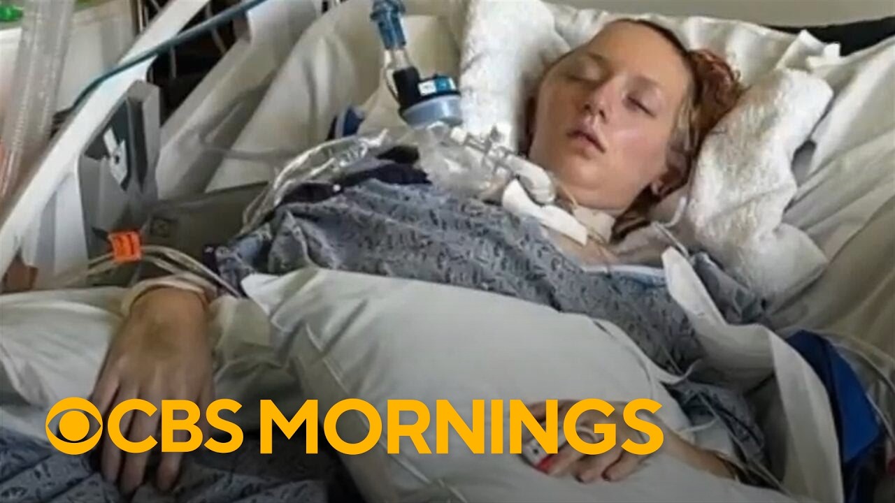 Six Flags' X2 roller coaster caused over 100 injuries, lawsuits say