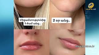 Ծերանալ՝ երիտասարդ մնալով